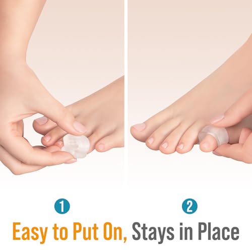Toe Spacers for Men & Women - 4 Gel Separators for Overlapping & Curled Toes