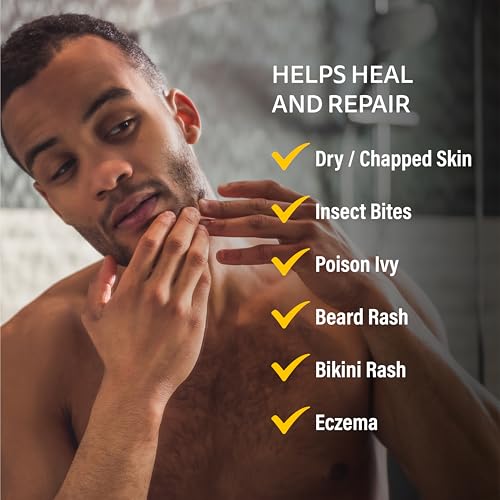 Medicated Rash Ointment