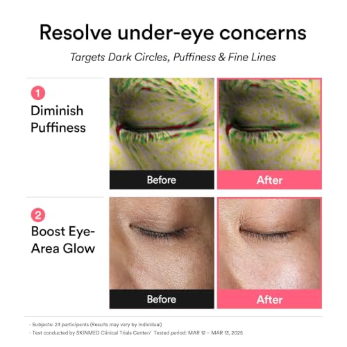 PDRN Retinal Eye Patches
