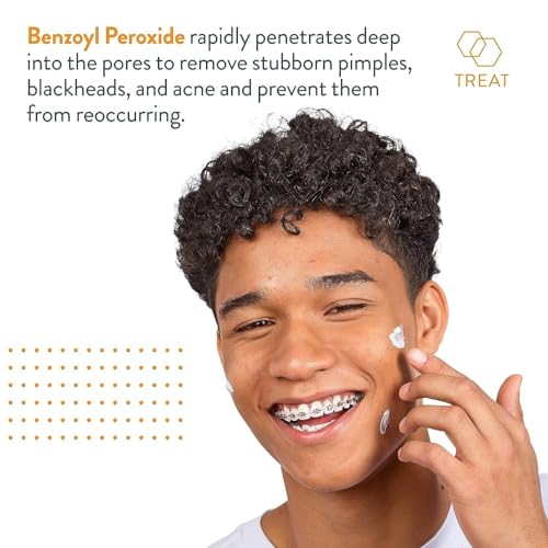 Terminator 10 Benzoyl Peroxide Spot Treatment