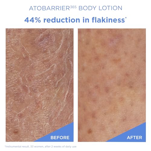 ATOBARRIER365 Korean Body Lotion with Ceramides & Glycerin