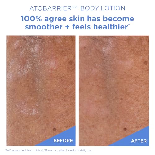 ATOBARRIER365 Korean Body Lotion with Ceramides & Glycerin