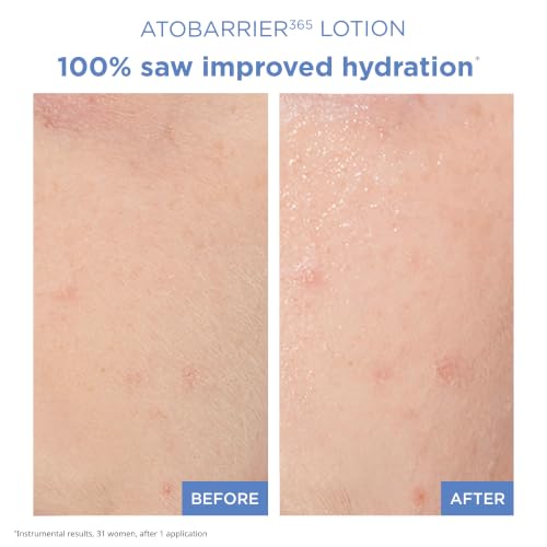ATOBARRIER365 Lightweight Hydrating Korean Face Moisturizer