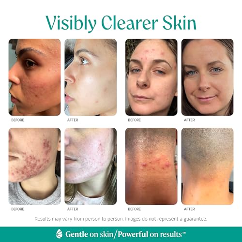 Mandelic Acid Level 1 face and body serum