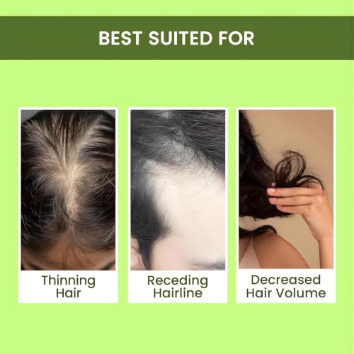 Alps Goodness Rosemary Water Spray for Hair Growth |