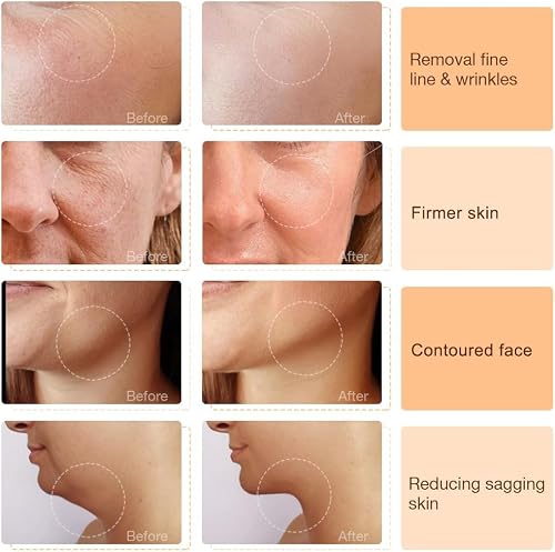 6 in 1 RF Radio Frequency Face Beauty Device
