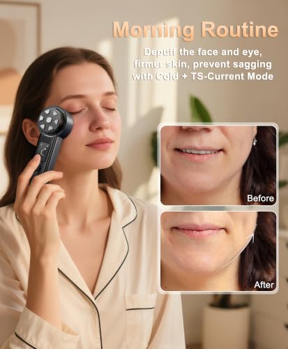 6 in 1 RF Radio Frequency Face Beauty Device