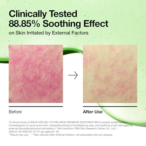 Azelaic Acid 10 HA Soothing Pads