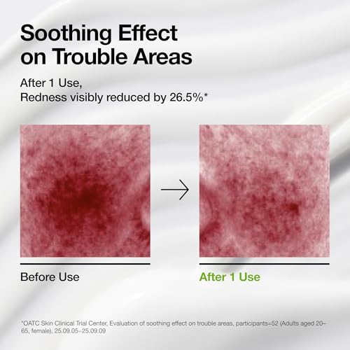 Azelaic Acid CICA Skin Soothing Moisturizer