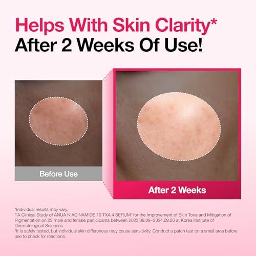 Niacinamide 10% + TXA 4% Serum