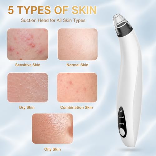 Blackhead Remover Tools Electric Vacuum Facial Pore Cleaner White