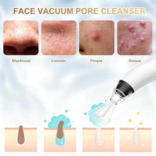 Blackhead Remover Tools Electric Vacuum Facial Pore Cleaner White