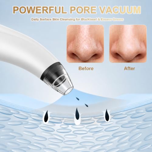 Blackhead Remover Tools Electric Vacuum Facial Pore Cleaner White