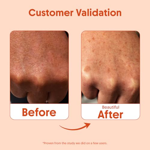 Daily Oil-Free Body Sunscreen Lotion SPF 50 Broad Spectrum 80-Min