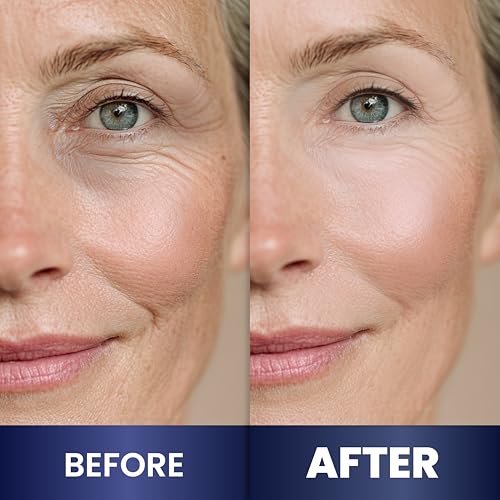 Night Cream for Women Anti Aging - Night Moisturizer with Retinol