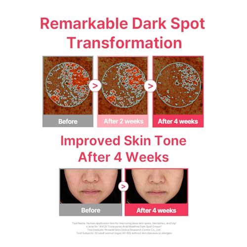 Tranexamic Acid & Niacinamide Radiance Moisturizer