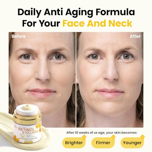 Retinol Cream for Face Anti Aging: Wrinkle Cream for Face Neck