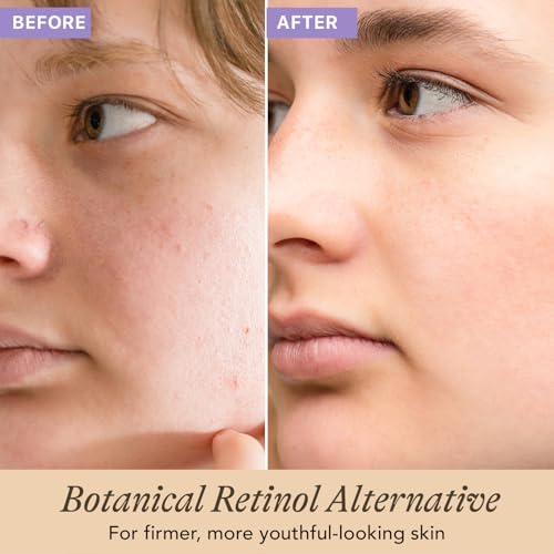 Bakuchiol Serum