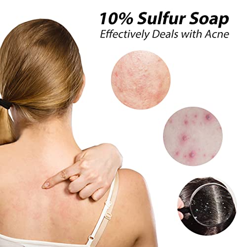Bee and Flower Shanghai 10% sulfur soap 6 pack