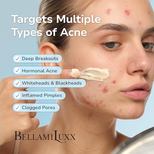 Cystic Acne Treatment for Face: Hormonal Acne Treatment Cream for Teens & Adults - Salicyl