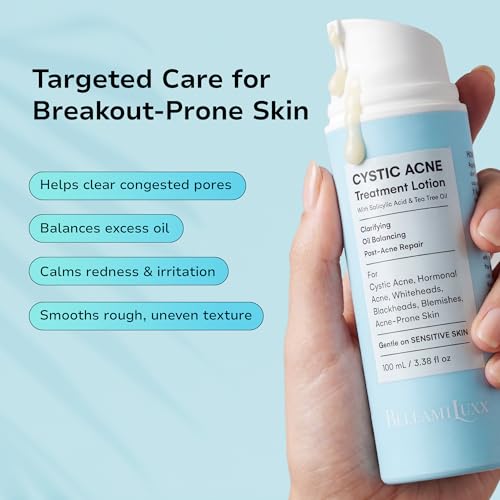 Cystic Acne Treatment for Face: Hormonal Acne Treatment Cream for Teens & Adults - Salicyl