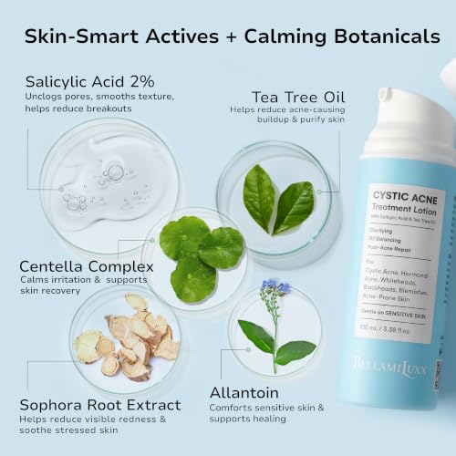 Cystic Acne Treatment for Face: Hormonal Acne Treatment Cream for Teens & Adults - Salicyl