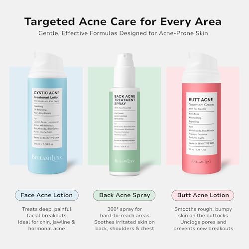 Cystic Acne Treatment for Face: Hormonal Acne Treatment Cream for Teens & Adults - Salicyl