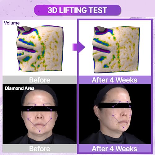 Probioderm 3D Lifting Ampoule