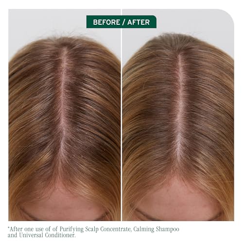 Scalp Sync Calming Shampoo – For Dry/Sensitive Scalps