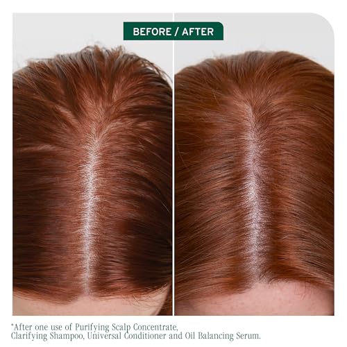 Scalp Sync Clarifying Shampoo – For Oily Scalp
