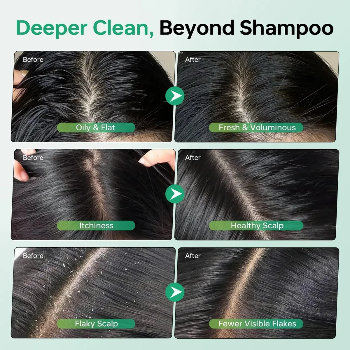 Scalp Scrub, Rosemary Tea Tree Exfoliator Shampoo