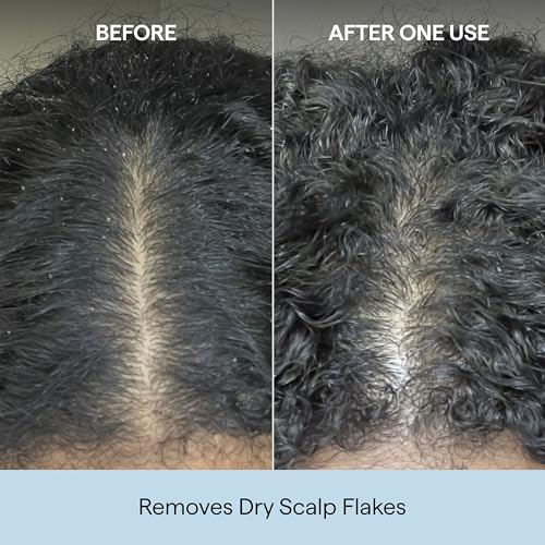 Scalp Revival Charcoal + Coconut Oil Micro-Exfoliating Shampoo, Travel 2-Pack