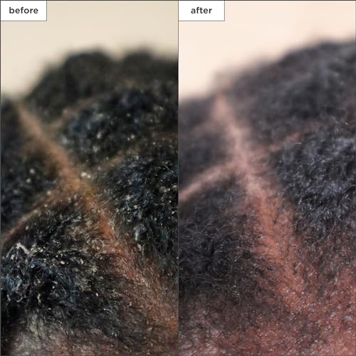 Scalp Revival Charcoal Tea Tree Treatment