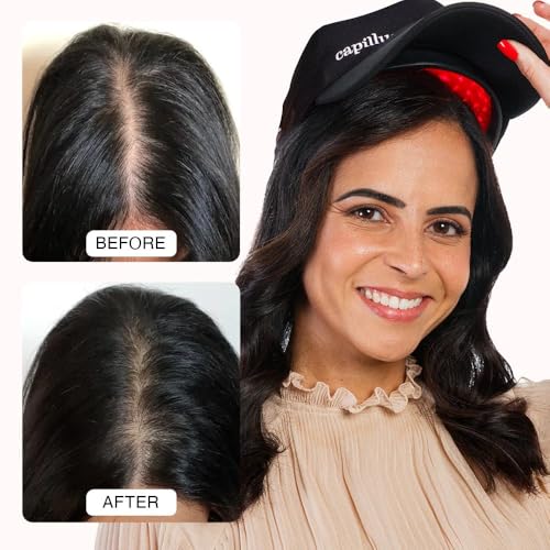PRO Laser Cap