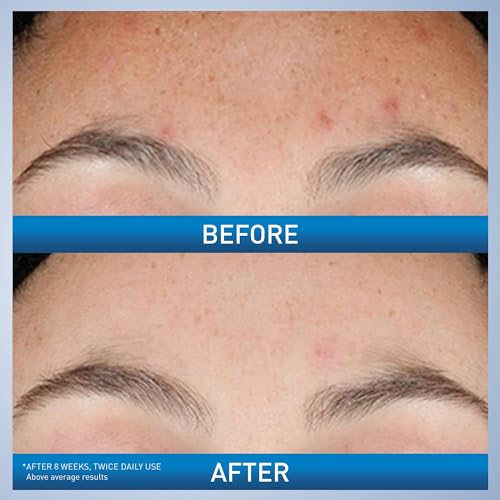 Resurfacing Retinol Face Serum with Niacinamide