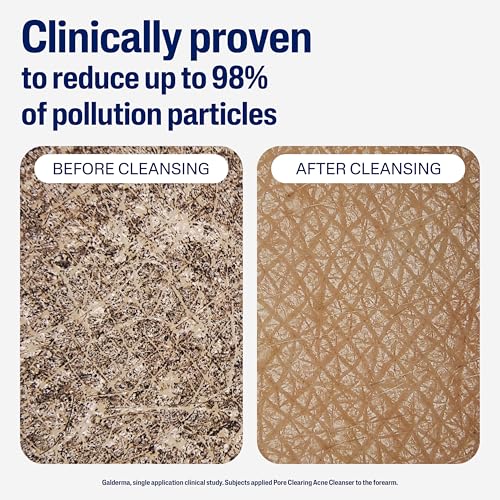 Gentle Clear Clarifying Acne Cream Cleanser foaming