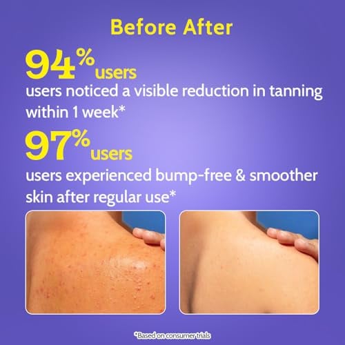 Body Wash Exfoliating For Dry Rough Bumpy Strawberry Skin With 1% Salicylic Acid 2% Lactic