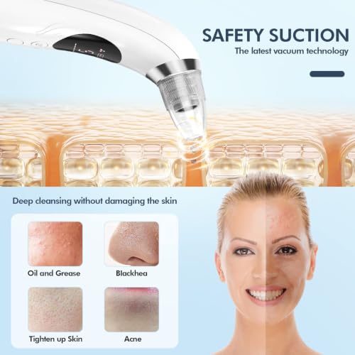Blackhead Remover Pore Vacuum Upgraded 5 Suction Power Levels