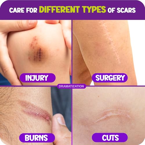 Advanced Scar Gel for Kids