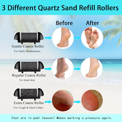 Electric Foot Callus Remover Rechargeable Waterproof Pedicure File