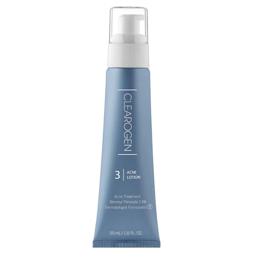 Acne Lotion with Benzoyl Peroxide