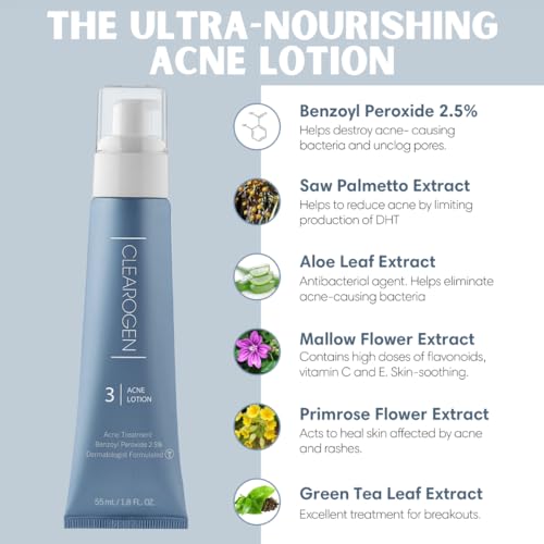 Acne Lotion with Benzoyl Peroxide