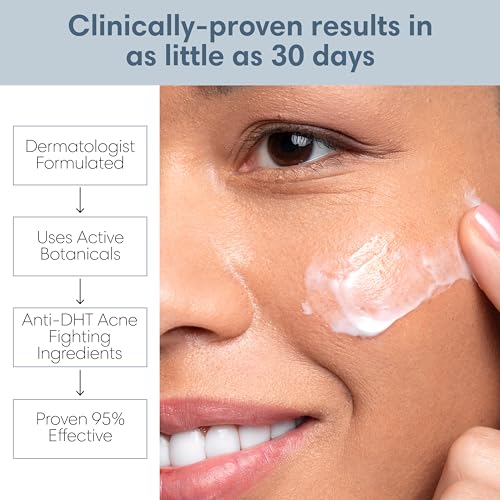 Acne Lotion with Benzoyl Peroxide