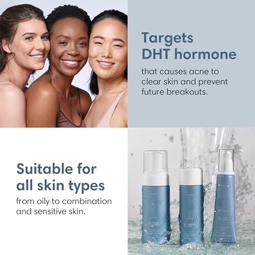 Acne Lotion with Benzoyl Peroxide