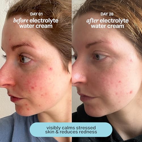 Electrolyte Water Cream, Lightweight Face Moisturizer, 1.7 Fl Oz