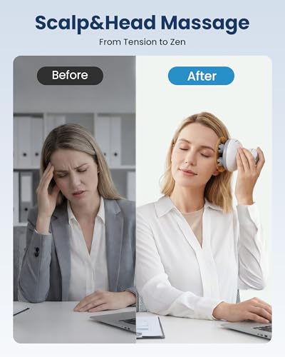 Scalp Massager for Hair Growth Electric Head Massager Tangle-Free