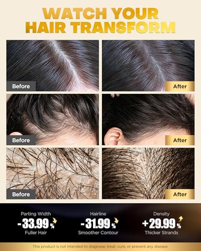 Tripeptide-Infused Biotin Hair Growth Shampoo and Conditioner Set