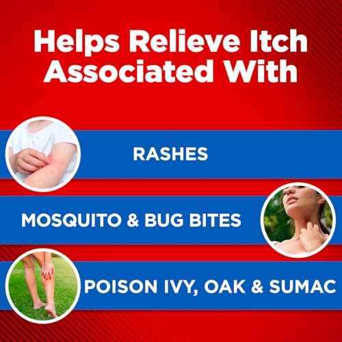 Maximum Strength Soothing Aloe Itch Relief Cream, 1% Hydrocortisone