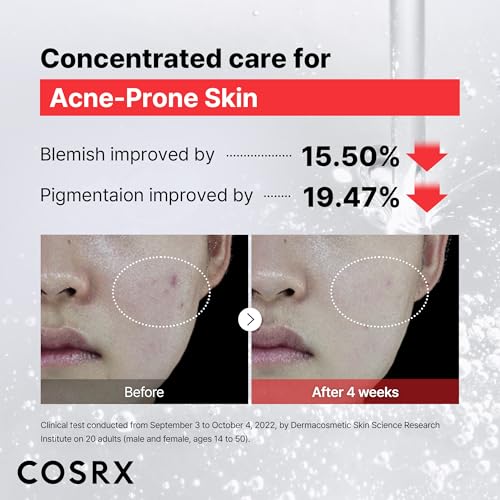 15% Niacinamide Serum