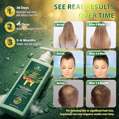 Rosemary & Batana Oil Hair Growth Shampoo